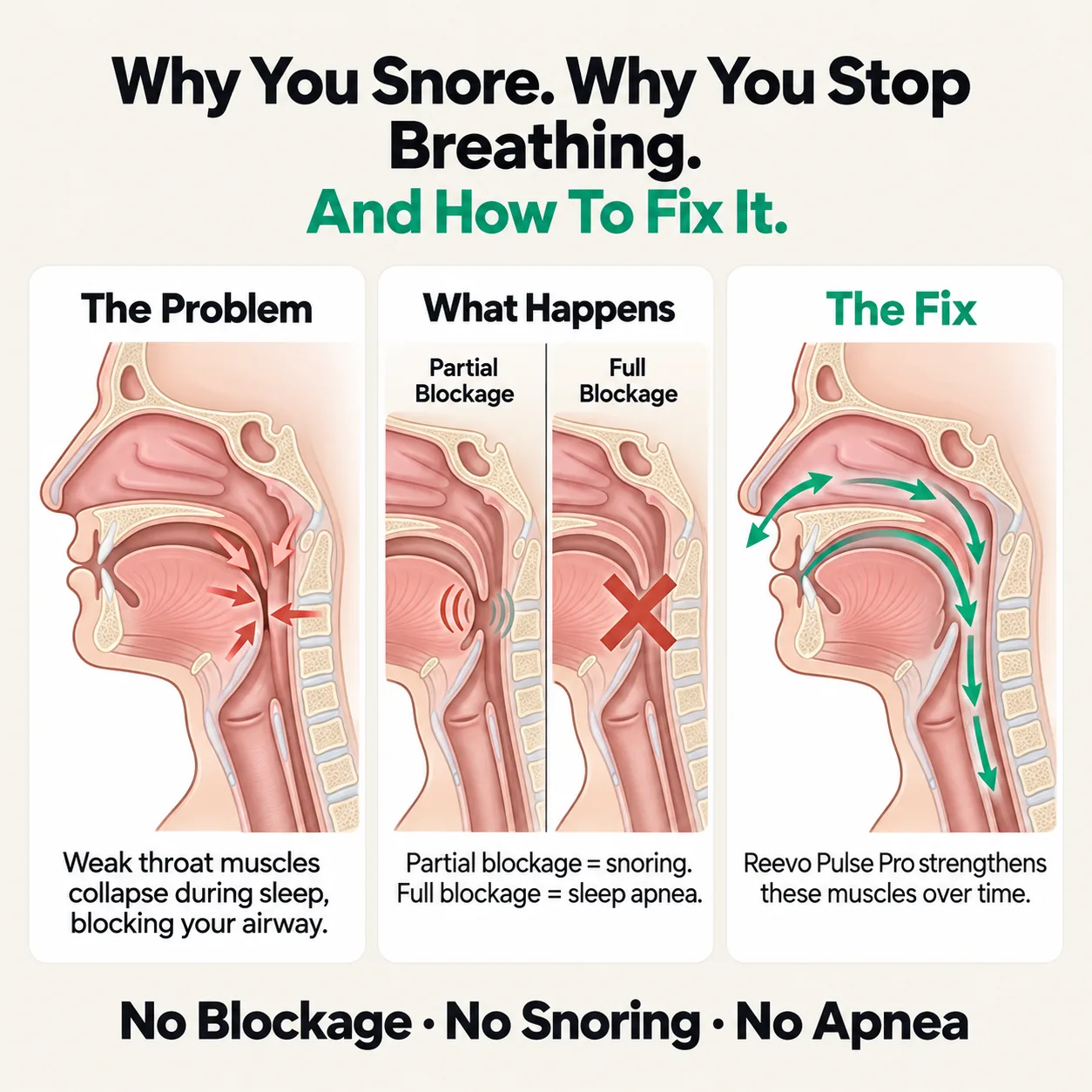 Why you stop breathing and how Reevo fixes it