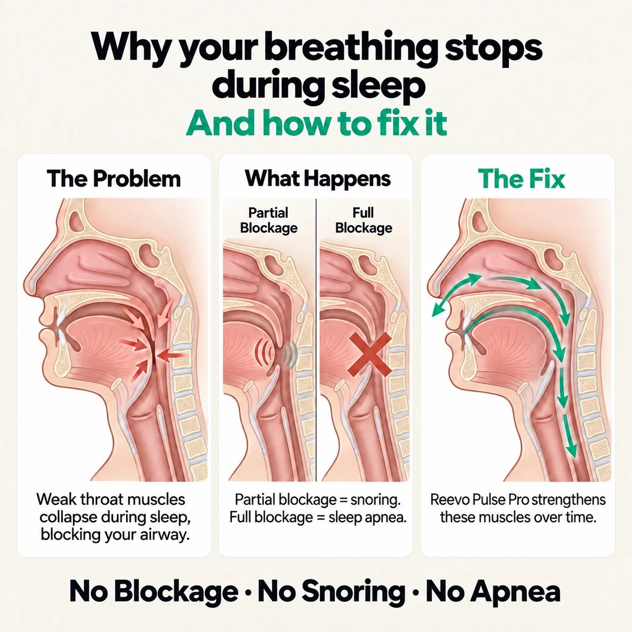 Why your breathing stops during sleep and how Reevo fixes it